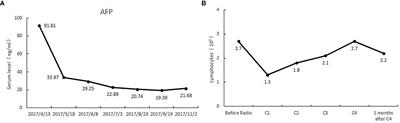 Advanced HCC Patient Benefit From Neoantigen Reactive T Cells Based Immunotherapy: A Case Report